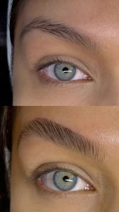 Resultado de Keu - Brow